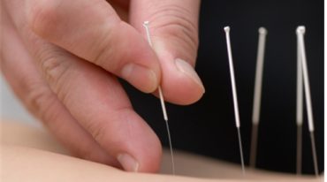 腰突症—腰三针 针刀治疗精确选点